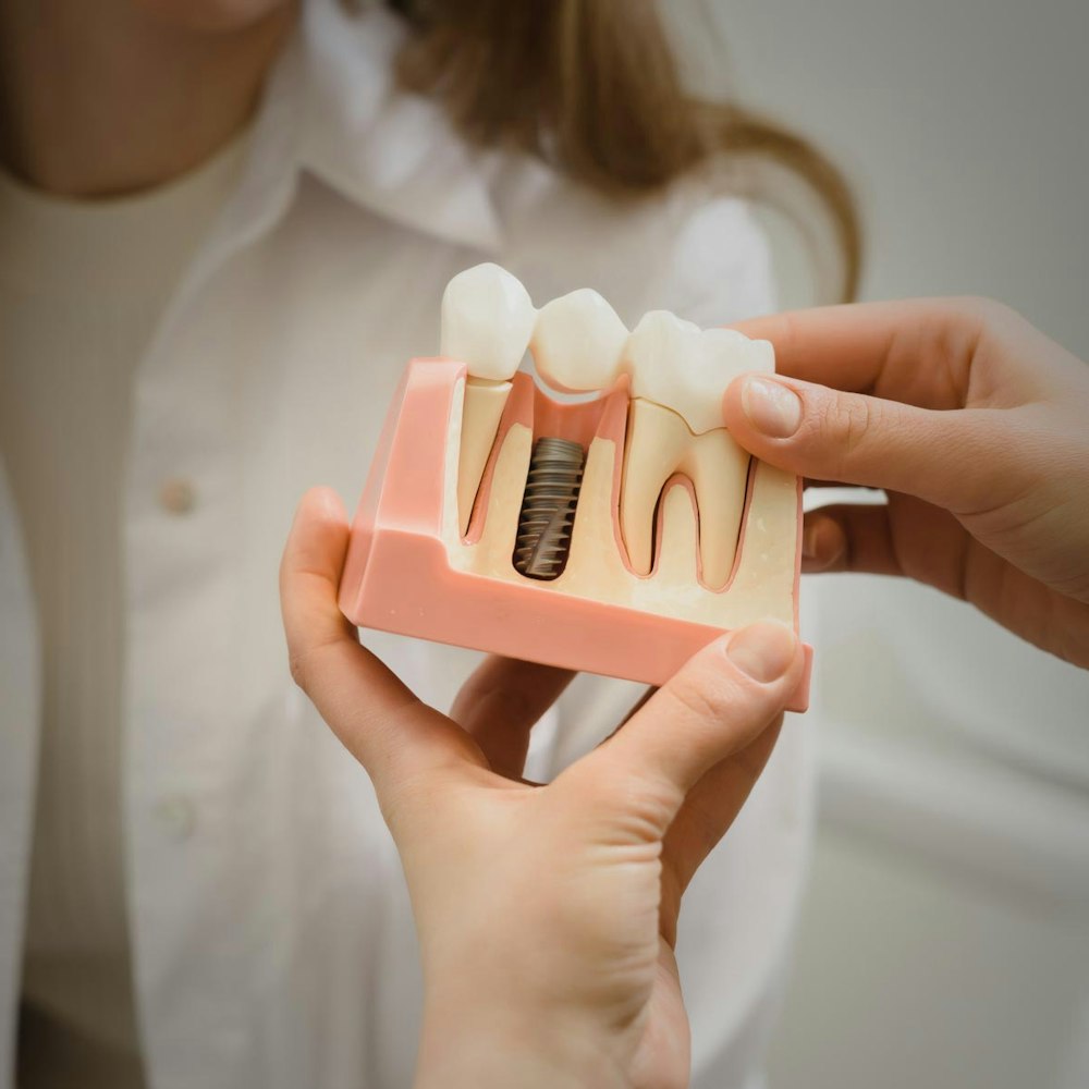 Illustration of restoration attaching to dental implant